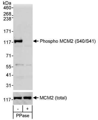 Western Blot: MCM2 [p Ser41] Antibody [NB100-2569] - Whole cell lysate (50 ug) from asynchronous 293T cells that was mock treated (-) or treated (+) with phosphatases (PPase).  Antibody used at 0.1 ug/ml. To examine total MCM2, the blot was stripped and then blotted with rabbit anti-MCM2 antibody at 0.1 ug/